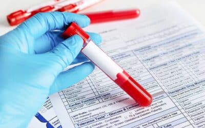 Allergietest beim Hund – wann er sinnvoll ist und wann du dir das Geld sparen kannst